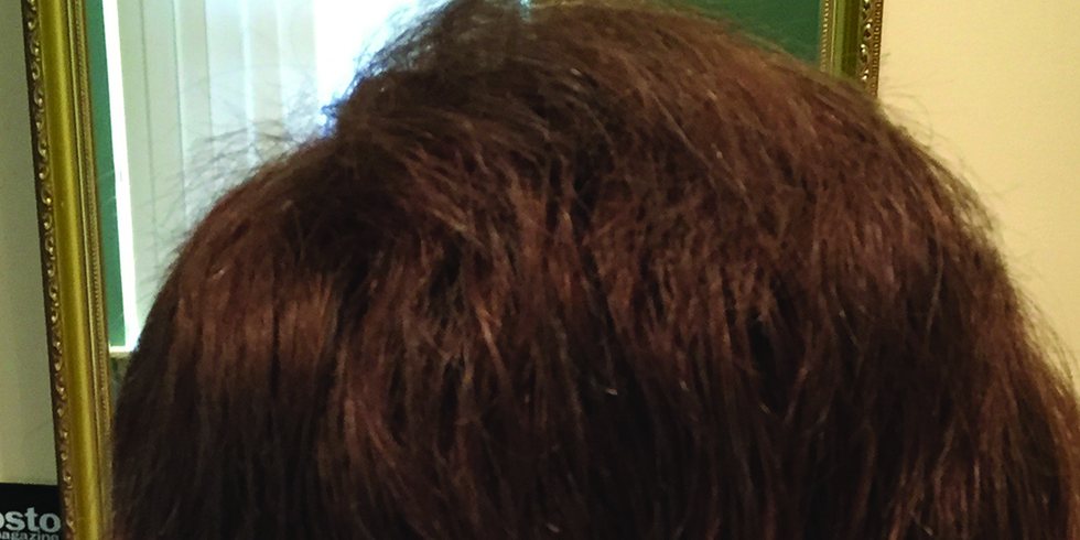 After: full dark hair across the crown