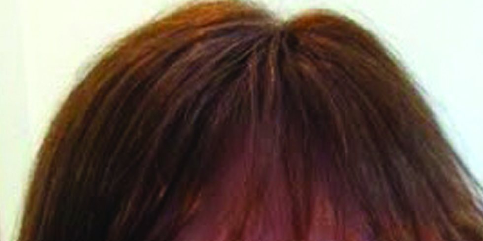 After: full natural hair, crown restored
