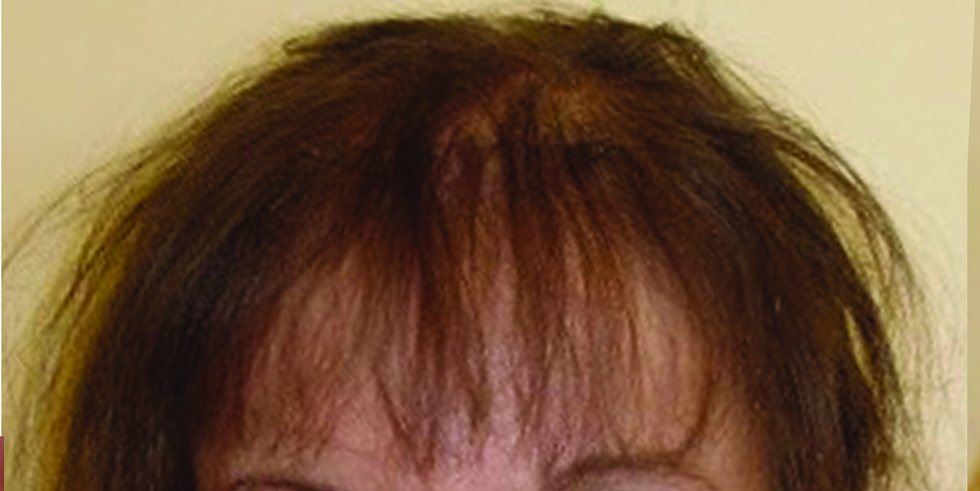 Before: fine, thinning auburn hair